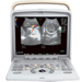 ECOGRAFO ECOCOLORDOPPLER PORTATILE CHISON Q5 - senza sonde